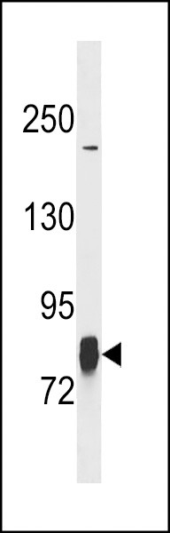 LIMK1 Antibody in Western Blot (WB)