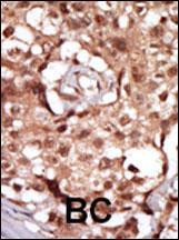 RIP2 Antibody in Immunohistochemistry (Paraffin) (IHC (P))