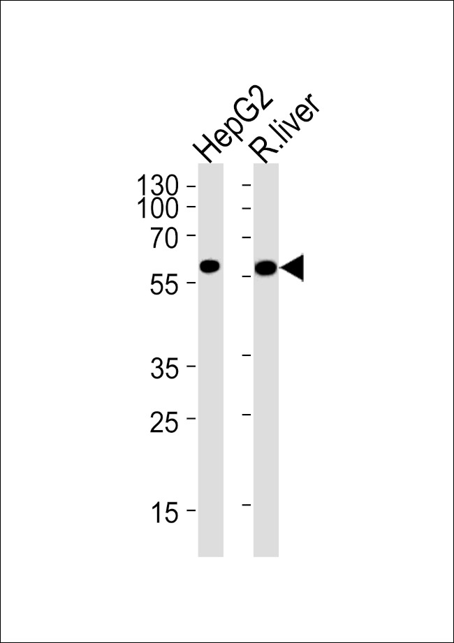 GCK Antibody in Western Blot (WB)