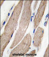 MEK5 Antibody in Immunohistochemistry (Paraffin) (IHC (P))