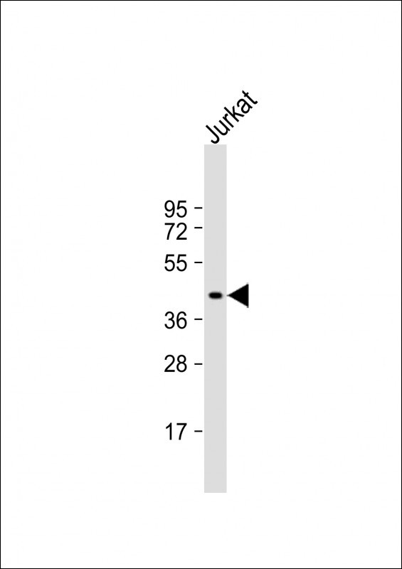 PIM1 Antibody in Western Blot (WB)