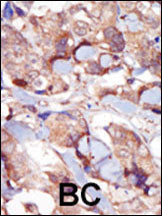 MLCK Antibody in Immunohistochemistry (Paraffin) (IHC (P))
