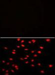 PI4K2A Antibody in Immunocytochemistry (ICC/IF)