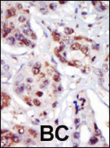PIP4K2C Antibody in Immunohistochemistry (Paraffin) (IHC (P))