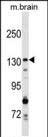 GAK Antibody in Western Blot (WB)