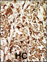 MOS Antibody in Immunohistochemistry (Paraffin) (IHC (P))