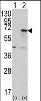 PKR Antibody in Western Blot (WB)