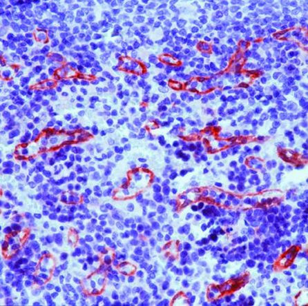 TGM2 Antibody in Immunohistochemistry (IHC)