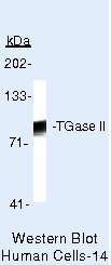 TGM2 Antibody in Western Blot (WB)