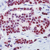 Estrogen Receptor alpha Antibody in Immunohistochemistry (Paraffin) (IHC (P))