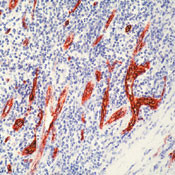 VWF Antibody in Immunohistochemistry (Paraffin) (IHC (P))