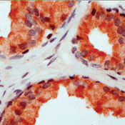 CD178 Antibody in Immunohistochemistry (IHC)