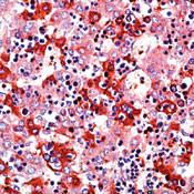 AFP Antibody in Immunohistochemistry (Paraffin) (IHC (P))