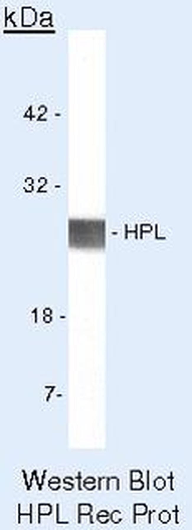 CSH1 Antibody in Western Blot (WB)