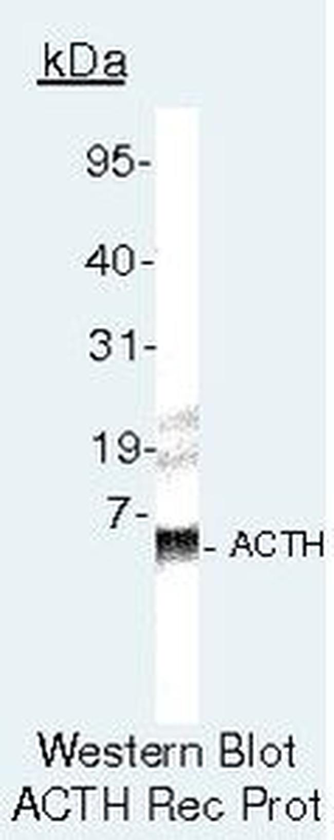 ACTH Antibody in Western Blot (WB)