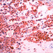 MMP9 Antibody in Immunohistochemistry (IHC)