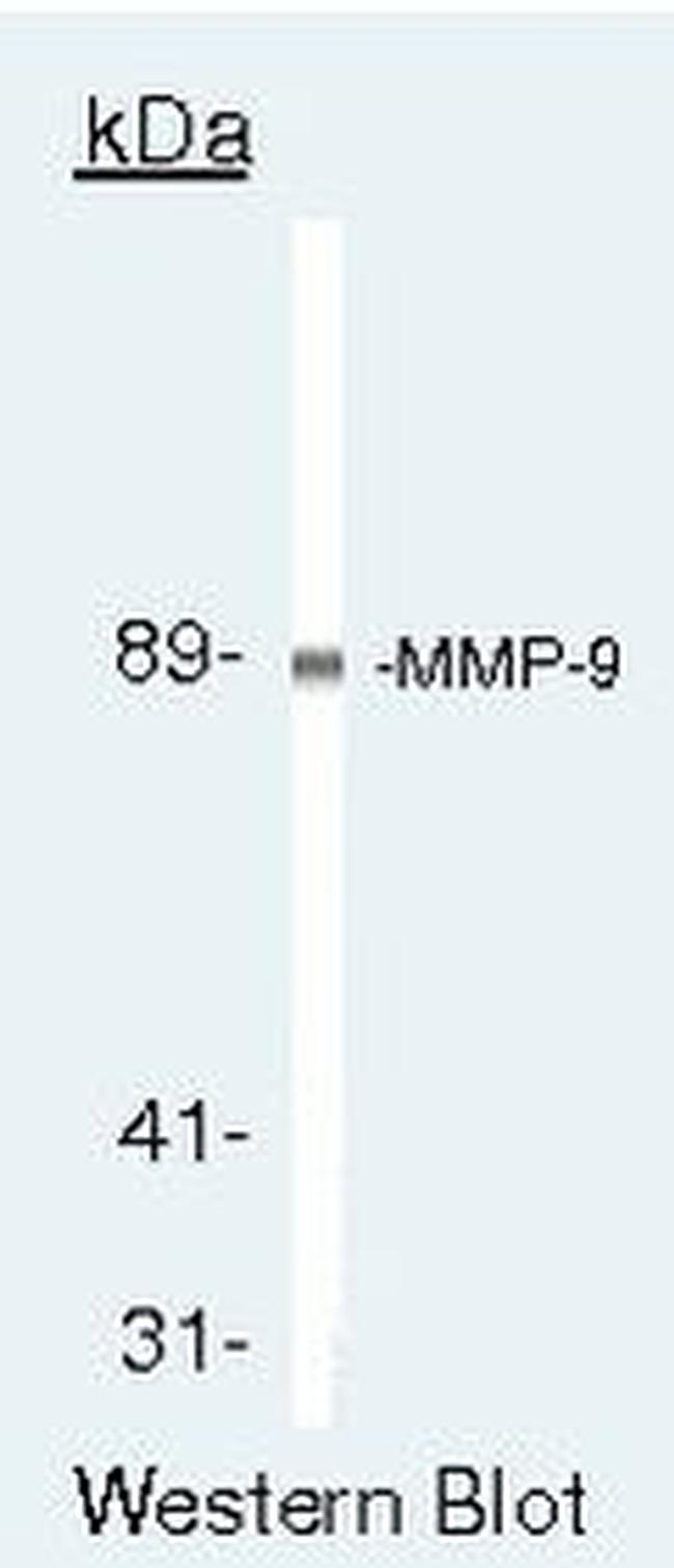 MMP9 Antibody in Western Blot (WB)