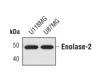 NSE Antibody in Western Blot (WB)