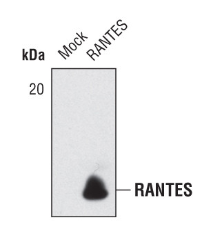 CCL5 (RANTES) Antibody in Western Blot (WB)