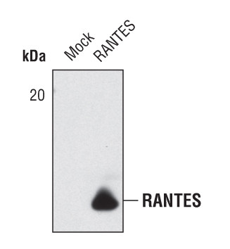 CCL5 (RANTES) Antibody in Western Blot (WB)