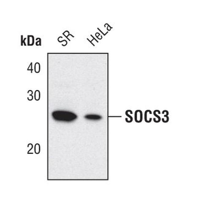 SOCS3 Antibody in Western Blot (WB)