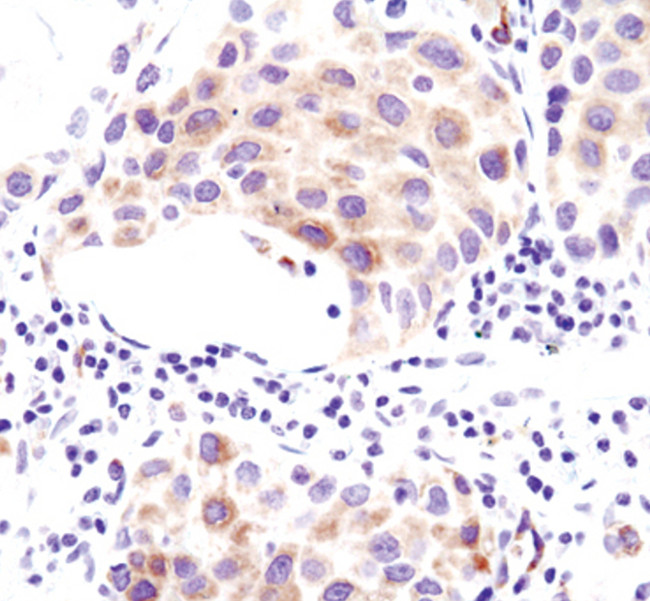 ACSL1 Antibody in Immunohistochemistry (Paraffin) (IHC (P))