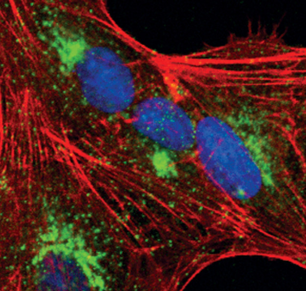 TGFBI Antibody in Immunocytochemistry (ICC/IF)