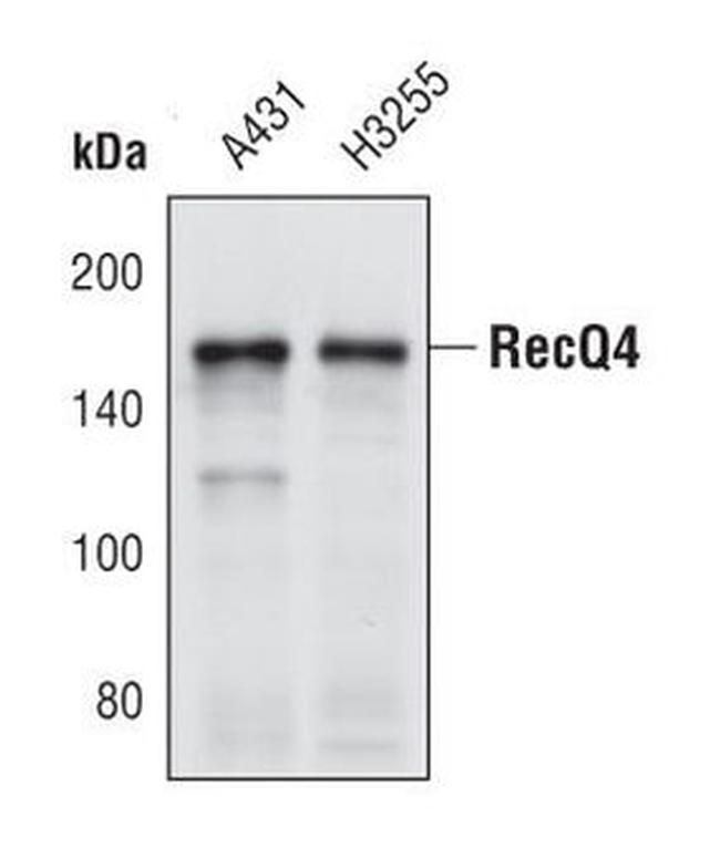 RECQ4 Antibody in Western Blot (WB)