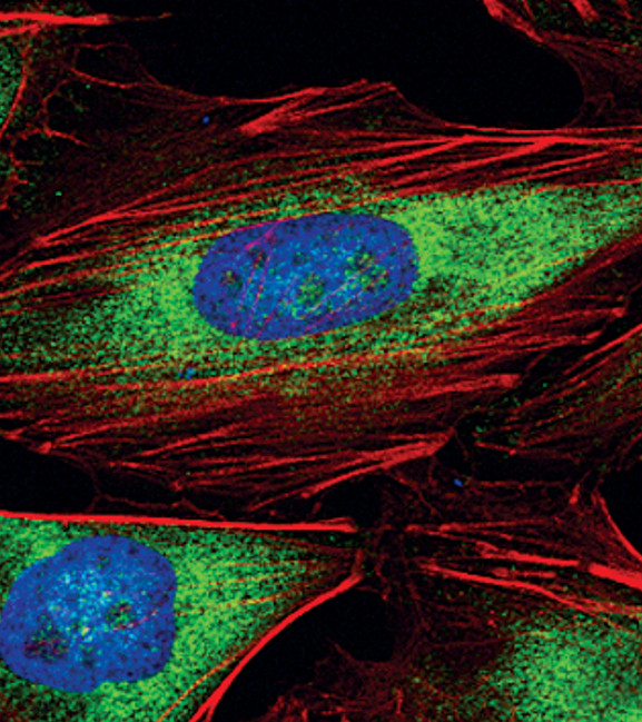 eIF3a Antibody in Immunocytochemistry (ICC/IF)