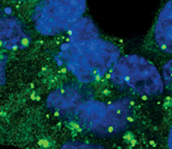 ATG12 Antibody in Immunocytochemistry (ICC/IF)