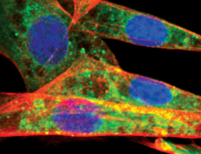 ATG12 Antibody in Immunocytochemistry (ICC/IF)