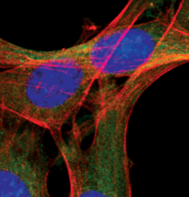 ATG12 Antibody in Immunocytochemistry (ICC/IF)