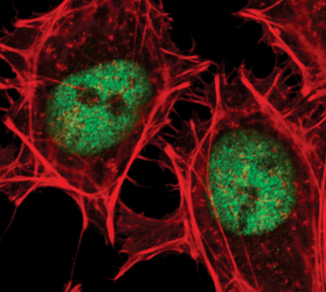 PBX1 Antibody in Immunocytochemistry (ICC/IF)