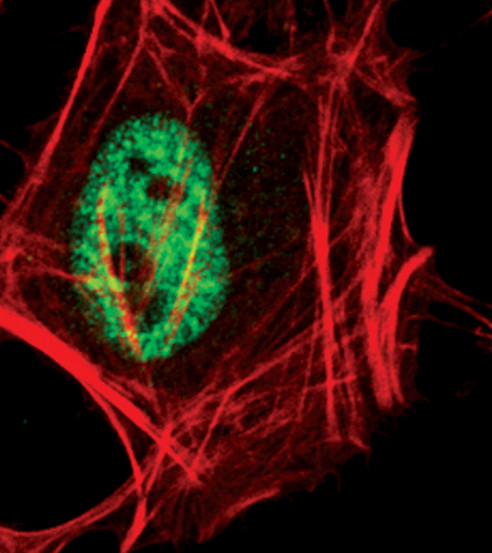 Phospho-RUNX1 (Ser249) Antibody in Immunocytochemistry (ICC/IF)