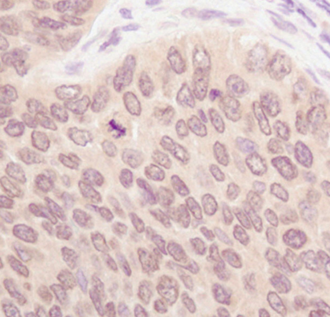 SUMO1 Antibody in Immunohistochemistry (Paraffin) (IHC (P))