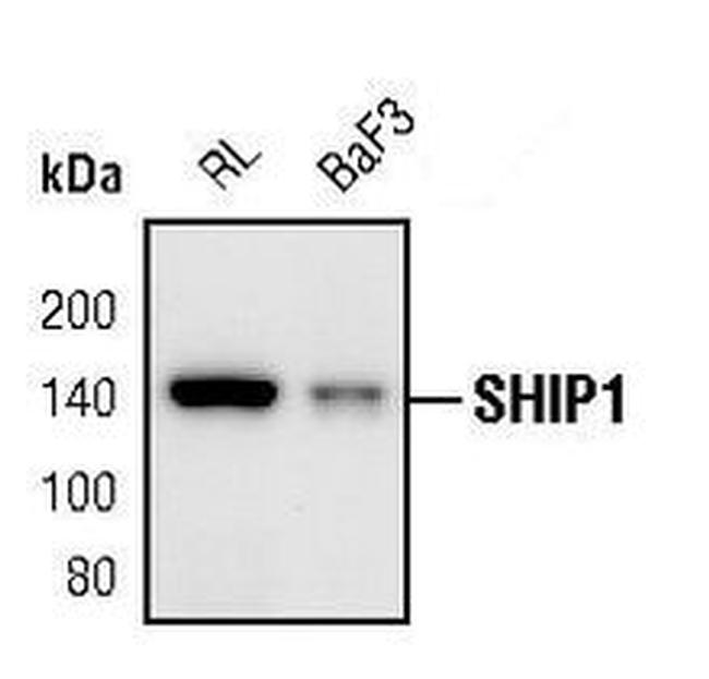 SHIP1 Antibody in Western Blot (WB)