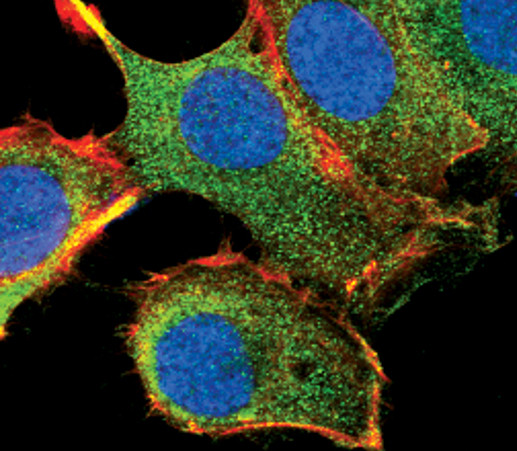 PAR4 Antibody in Immunocytochemistry (ICC/IF)