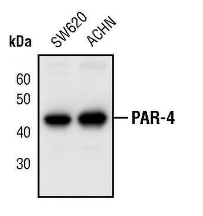 PAR4 Antibody in Western Blot (WB)