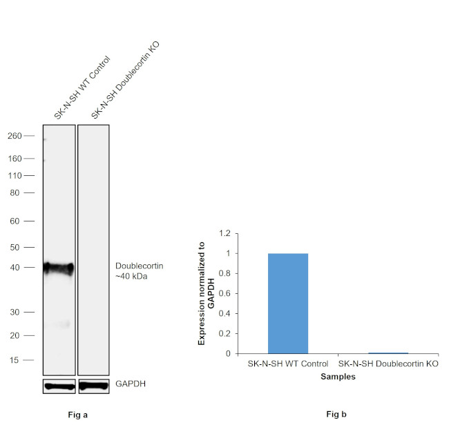 Doublecortin Antibody