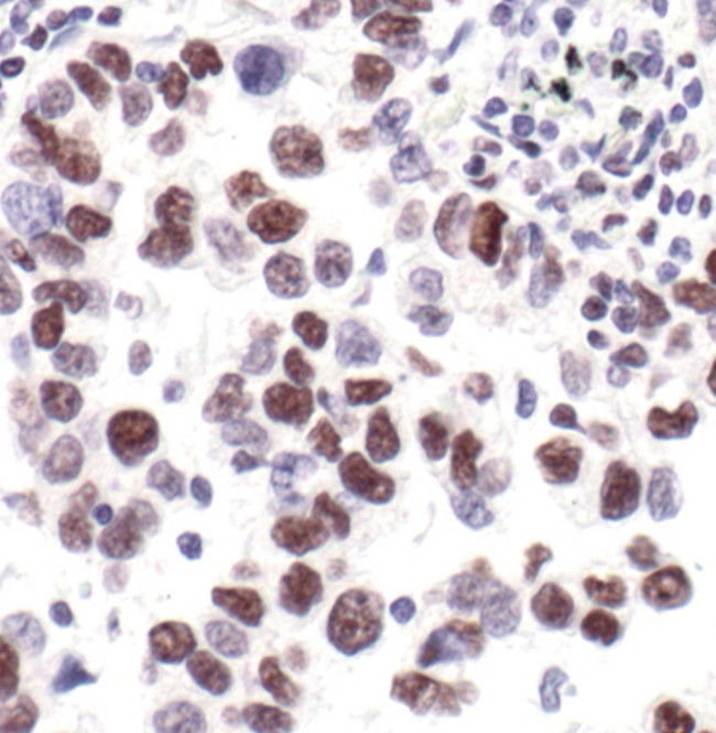 Phospho-RNA pol II CTD (Ser2, Ser5) Antibody in Immunohistochemistry (Paraffin) (IHC (P))