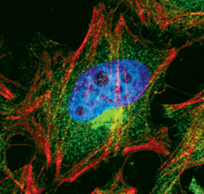 EEF2K Antibody in Immunocytochemistry (ICC/IF)