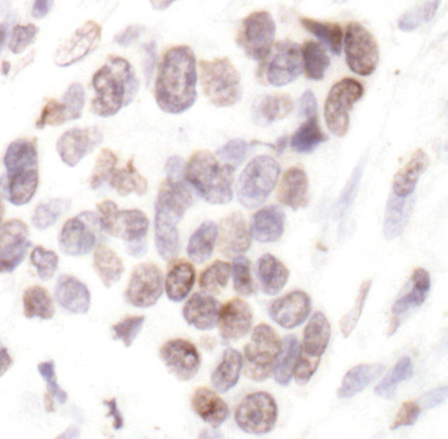 H2BK20ac Antibody in Immunohistochemistry (Paraffin) (IHC (P))