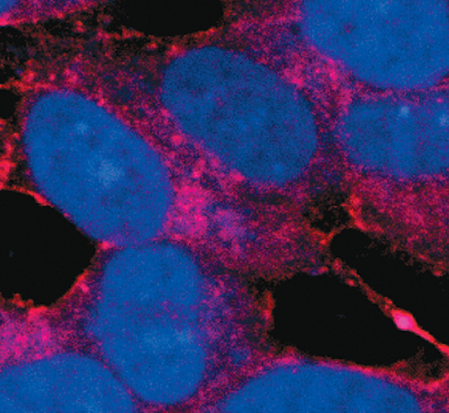 Amyloid Precursor Protein Antibody in Immunocytochemistry (ICC/IF)