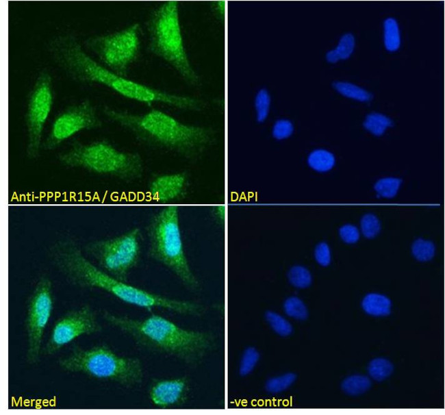 GADD34 Antibody in Immunocytochemistry (ICC/IF)