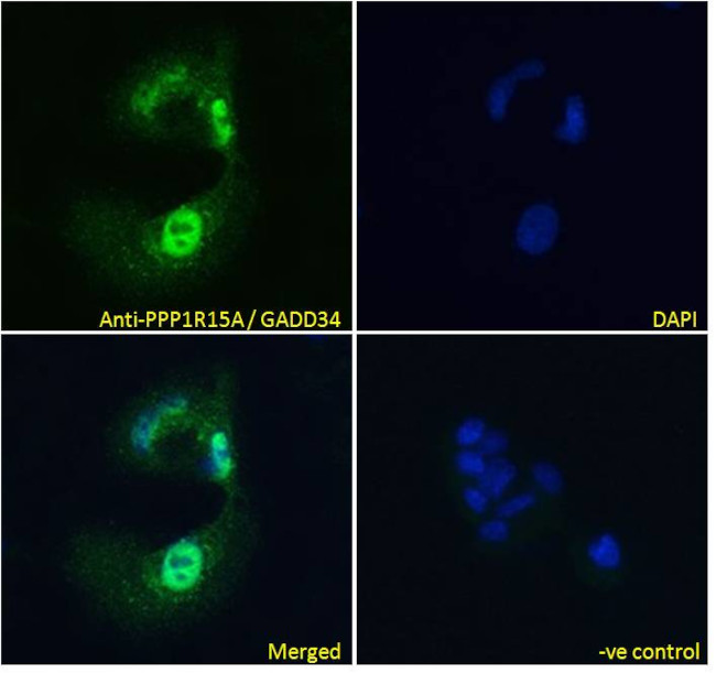 GADD34 Antibody in Immunocytochemistry (ICC/IF)