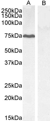 GADD34 Antibody in Western Blot (WB)