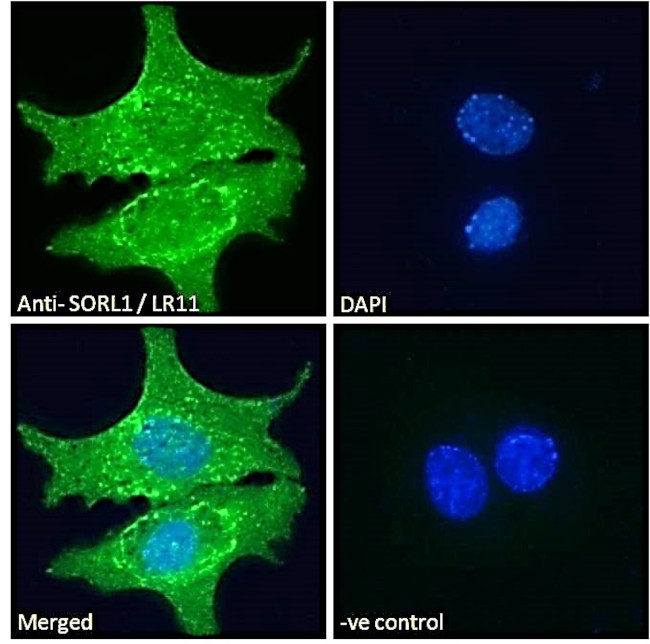 SORL1 Antibody in Immunocytochemistry (ICC/IF)