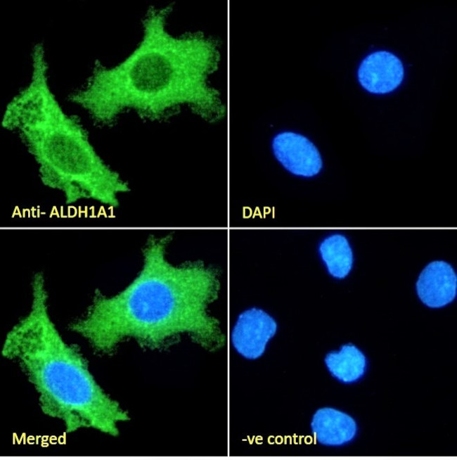 ALDH1A1 Antibody in Immunocytochemistry (ICC/IF)