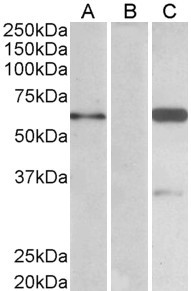 BAIAP2 Antibody in Western Blot (WB)