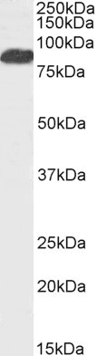 FOXP2 Antibody in Western Blot (WB)